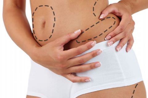 Aesthetic Surgery